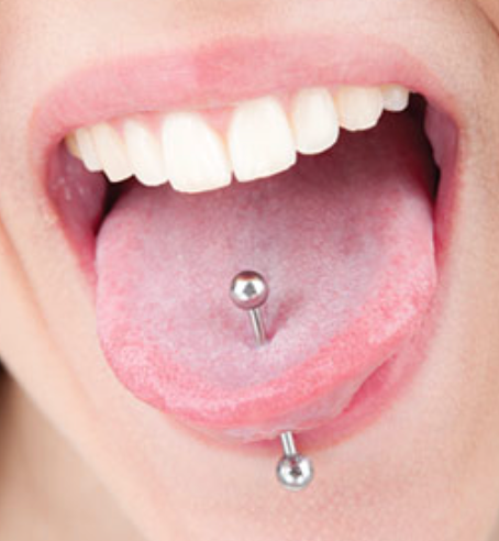 Tongue