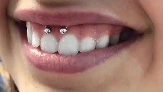 Smiley-10